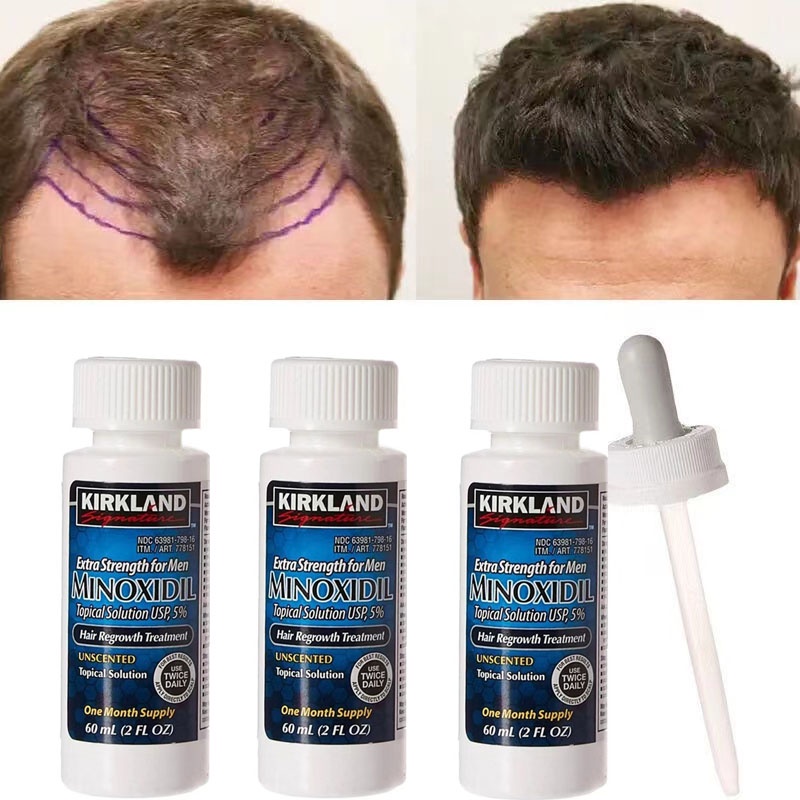 Kirkland Minoxidil 5 Extra Strength Hair Regrowth for Men 6 bottles