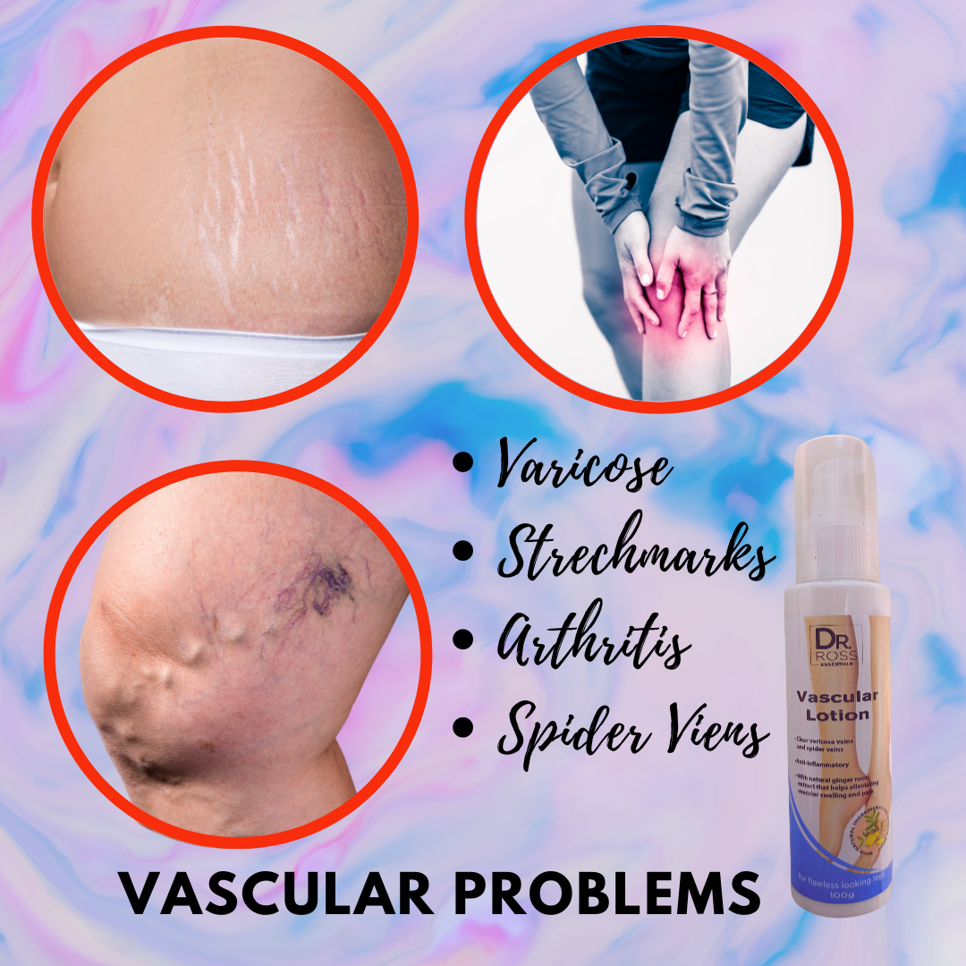 [100 All Natural Ingredients] Dr. Ross Vascular Lotion 1 Bottle BEST