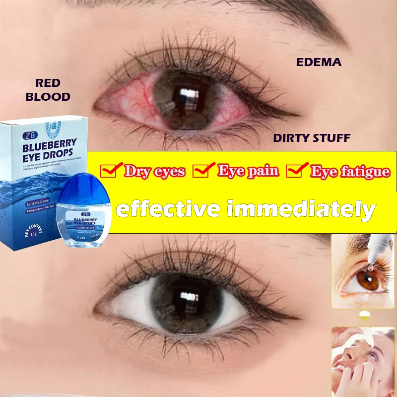 Original ZB 13ml Eyedrops Blueberries Eye Drops For Clear Vision Dry