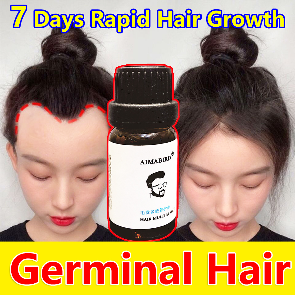 🔥Hair grows 6 times🔥Lowy Hair grower Hair Growth 100% pure natural  treatment Fast Powerful hair Helps Improve Hair Loss Promotes Nourishes Hair  Roots Repairs Dry Damaged Hair 10ml hair Grower for Men