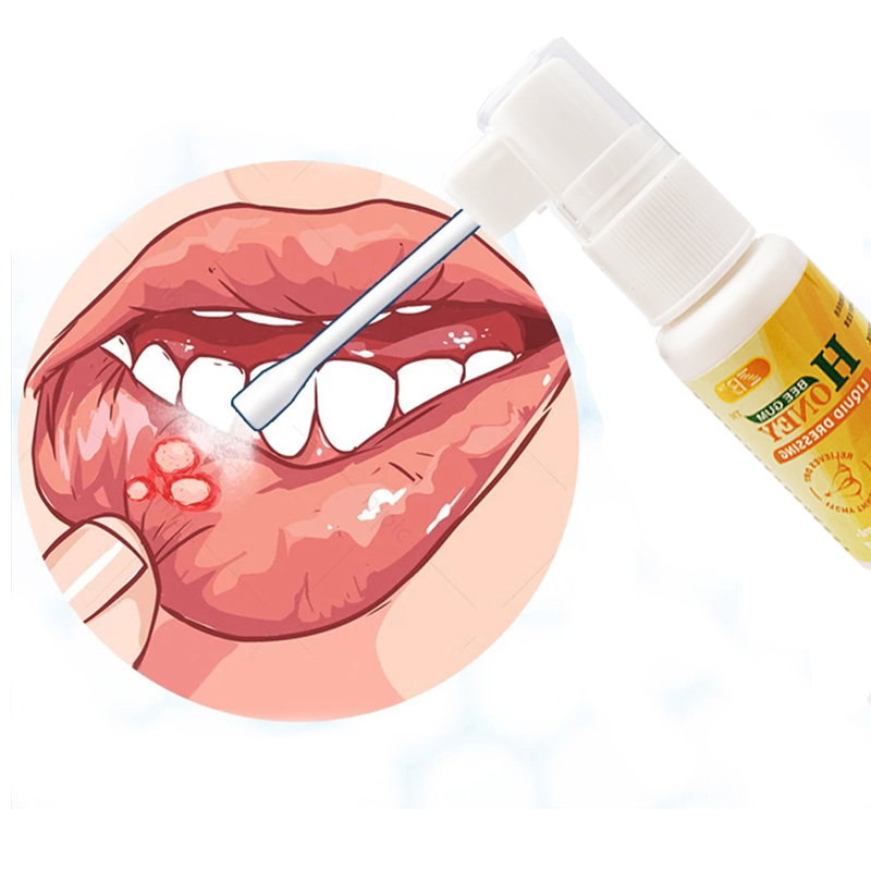 Natural Herbal Cool Oral Ulcer Pain Relieve Spray Propolis