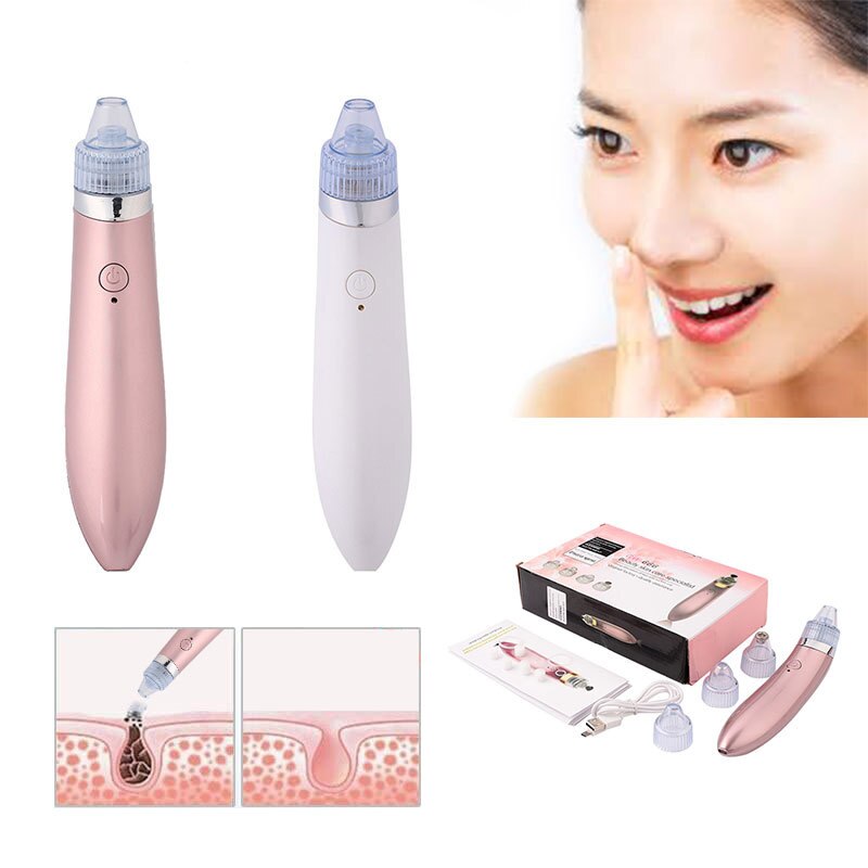 [S&P Shoppers Hub] Ultimate Blackhead Remover blackhead removal tools
