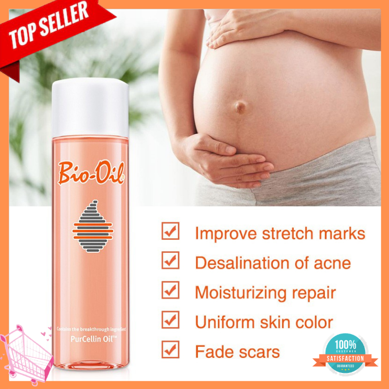 bio claire oil for stretch marks
