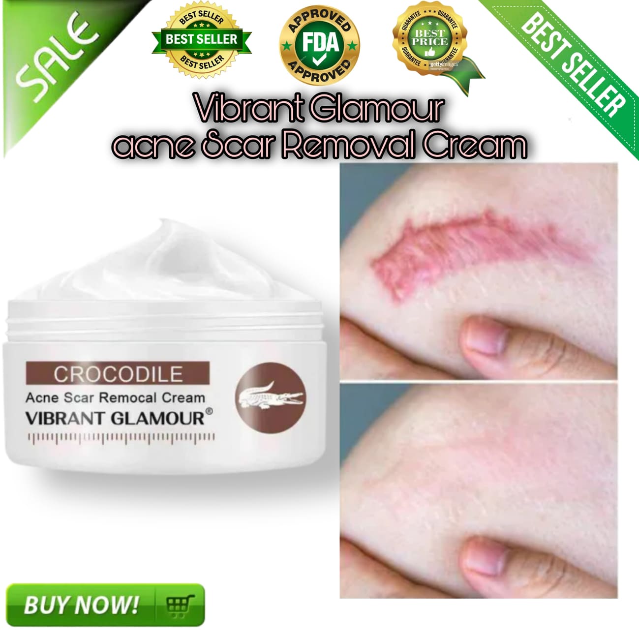 Hot 】AUTHENTIC VINT GLAMOUR Crocodile Scar Cream For Old Scars Stretch