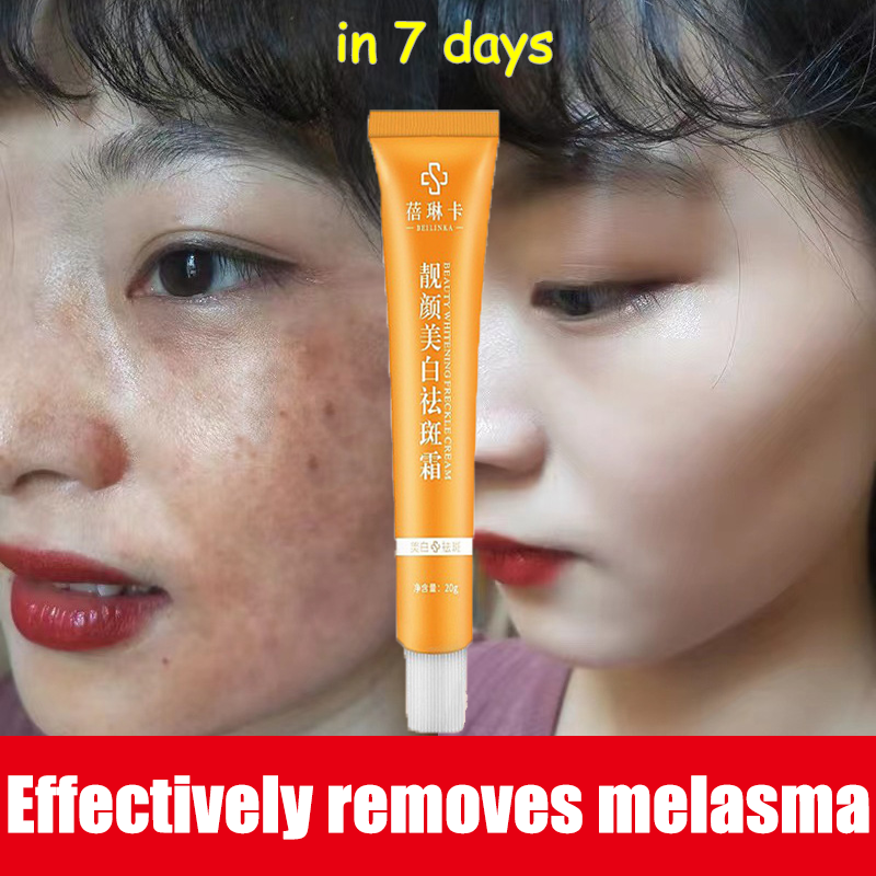 melasma cream original dark spots remover anti melasma Effectively