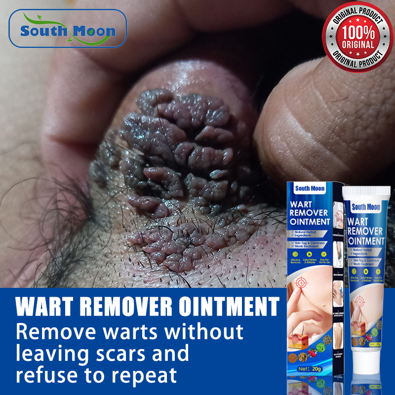 South Moon Warts Removal Serum Warts Remover Original Cream Wart Removing Liquid Genital Warts 9000