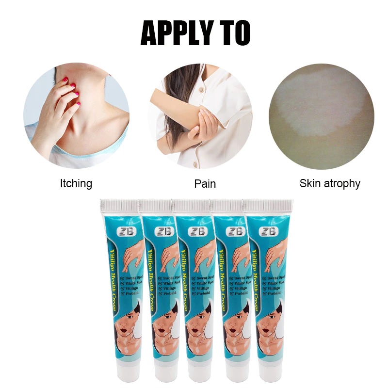 ZB Vitiligo Health Treatment Cream Sweat Spot, White Spot, Vitiligo