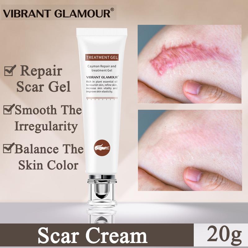 Acne Scar Remove Cream Surgical Burn Stretch Marks Removal Gel