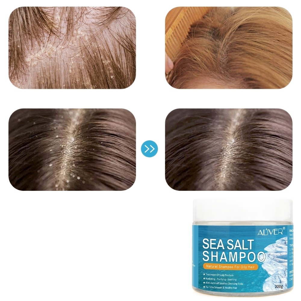 COD ALIVER Anti Dandruff Shampoo Hair Treatment For dandruff treatment