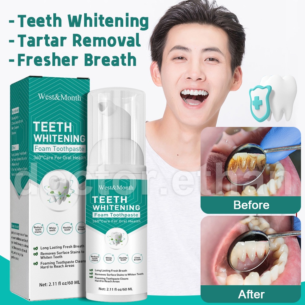 ALIVER Teeth whitening mousse toothpaste Remove Tartar Remove Plaqu ...