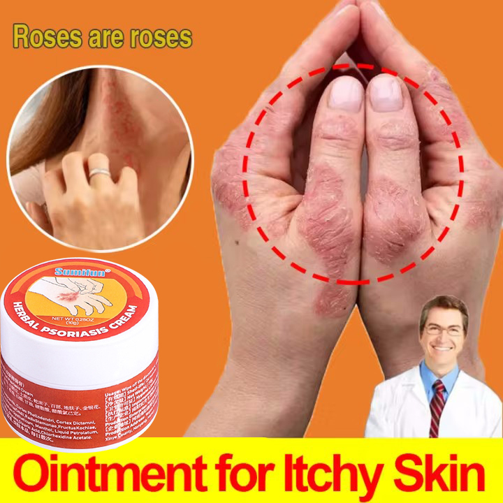 100effective Sumifun Psoriasis Cream Psoriasis Eczema cream Ringworm