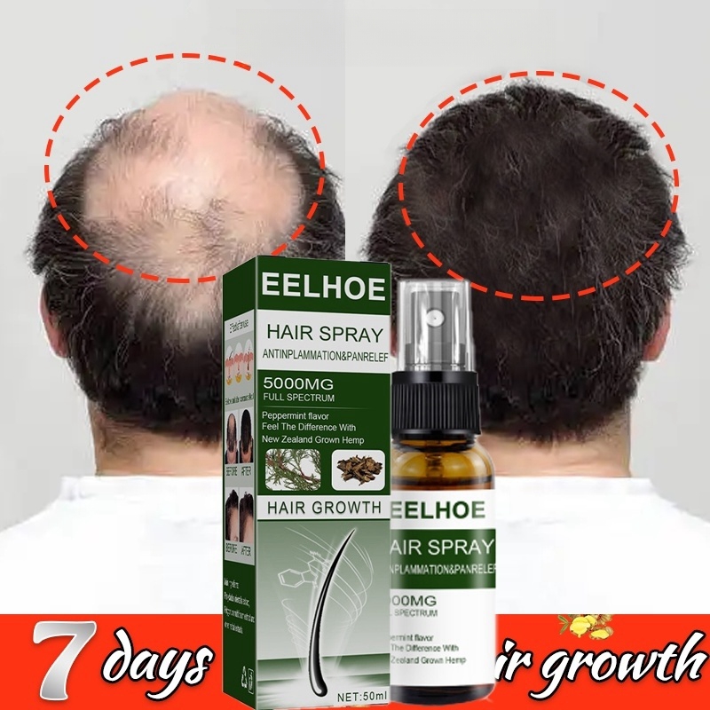 50ML EELHOE Ginger Hair Grower spray Anti Hair Loss Hair Growth ...