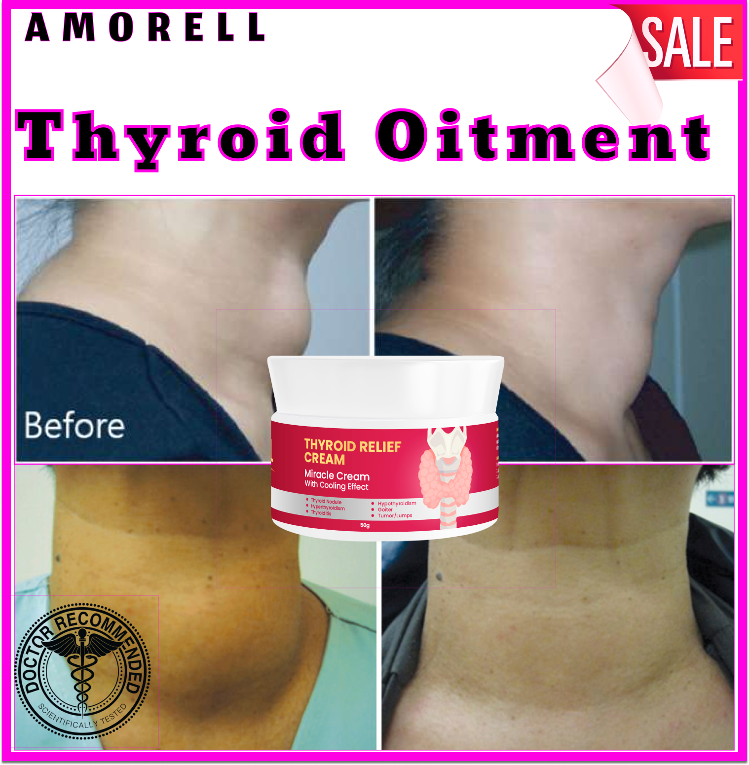 BEST SELLING THE BEST THYROID OINTMENT Thyroid Gland Nodule Care