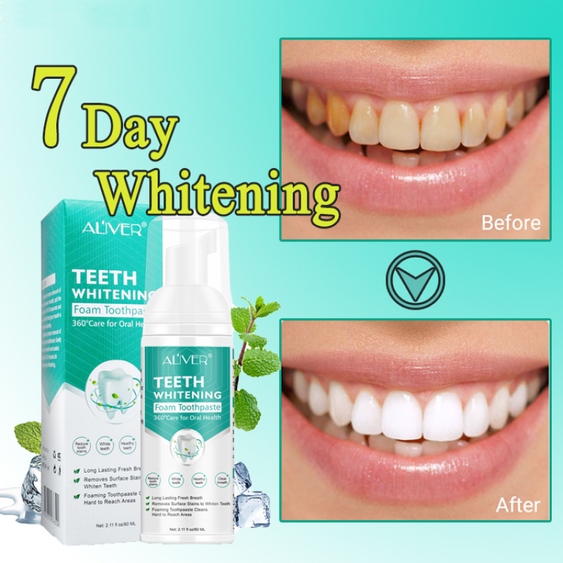 【60ML】ALIVER Teeth Whitening Mousse Toothpaste Teeth Whitening Yellowing of Teeth Foam