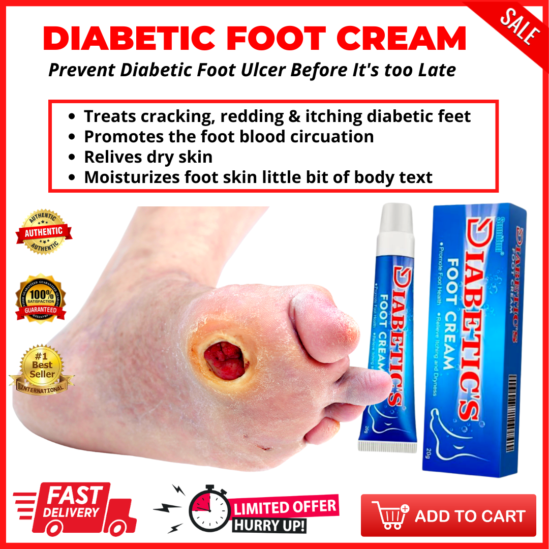 ️ ️ ️[FLASH SALE] ️ DIABETIC’S FOOT CREAM Sumifun Quick fix foot Repair ...