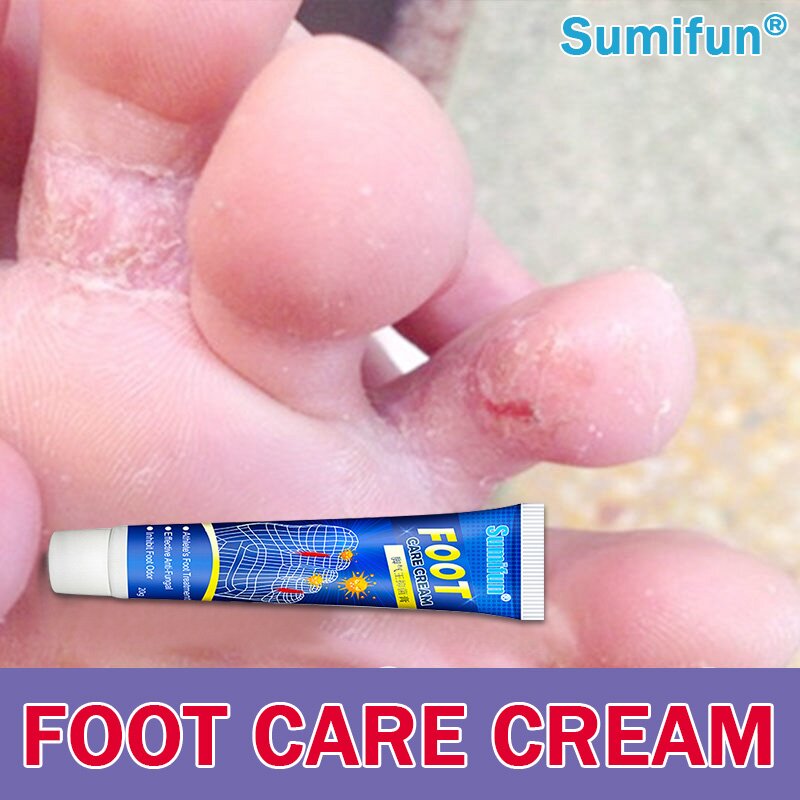 Athlete's foot cream Antifungal foot care cream Foot repair cream