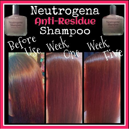 Neutrogena Shampoo 175ml authentic | Lazada PH