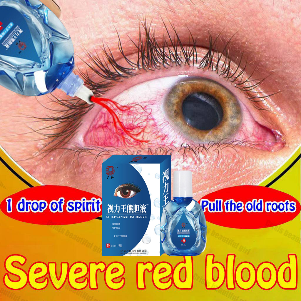 eye drops for cataract original 15ML eyedrops for tired eyes Dry sore ...