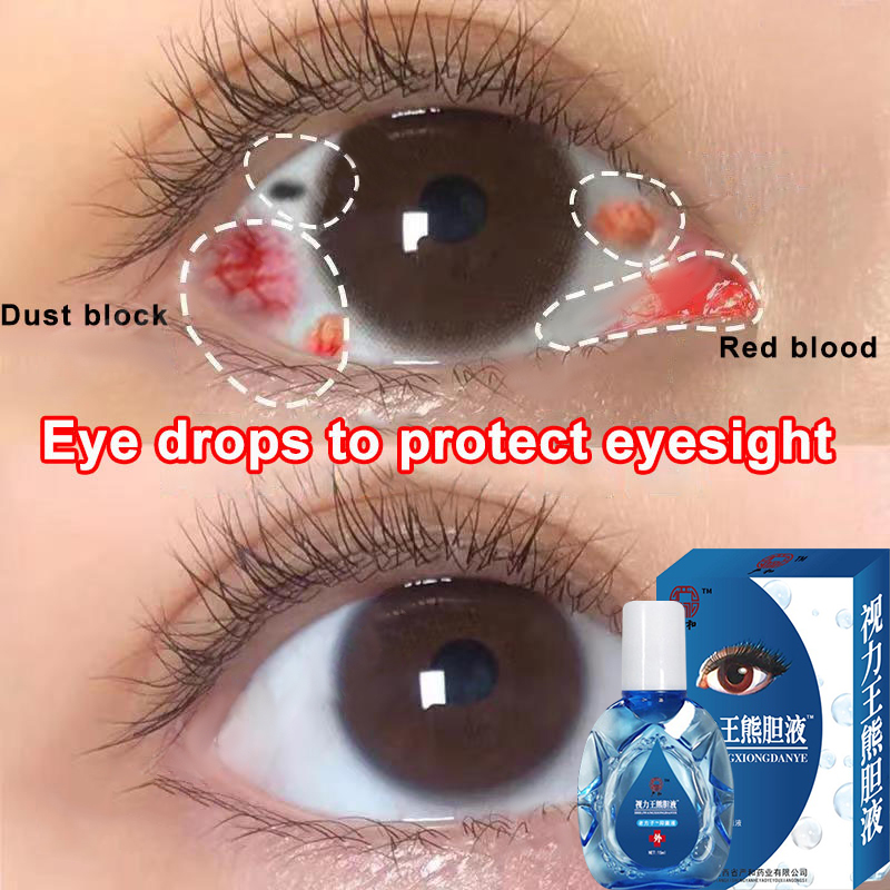 100 effective Eye drops original Eyedrops eye drops for clear vision