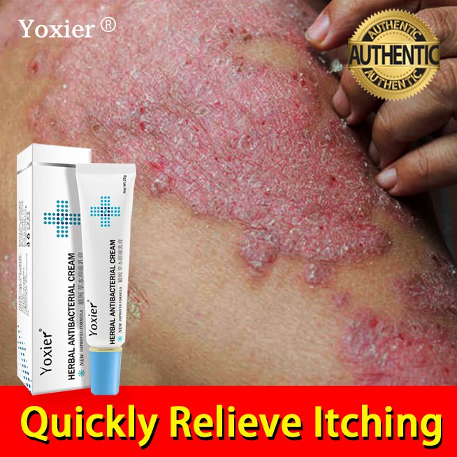 Psoriasis Ointment Antibacterial Cream Psoriasis Cream Eczema Cream