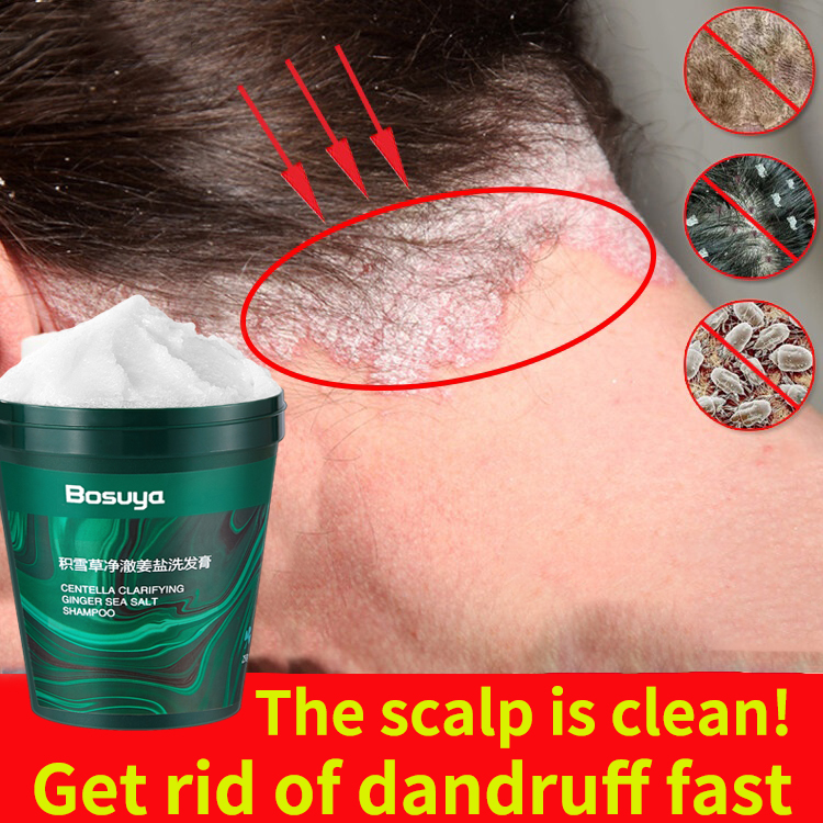 250g Sea Salt Shampoo Anti Dandruff Hair Treatment Shampoo effectively