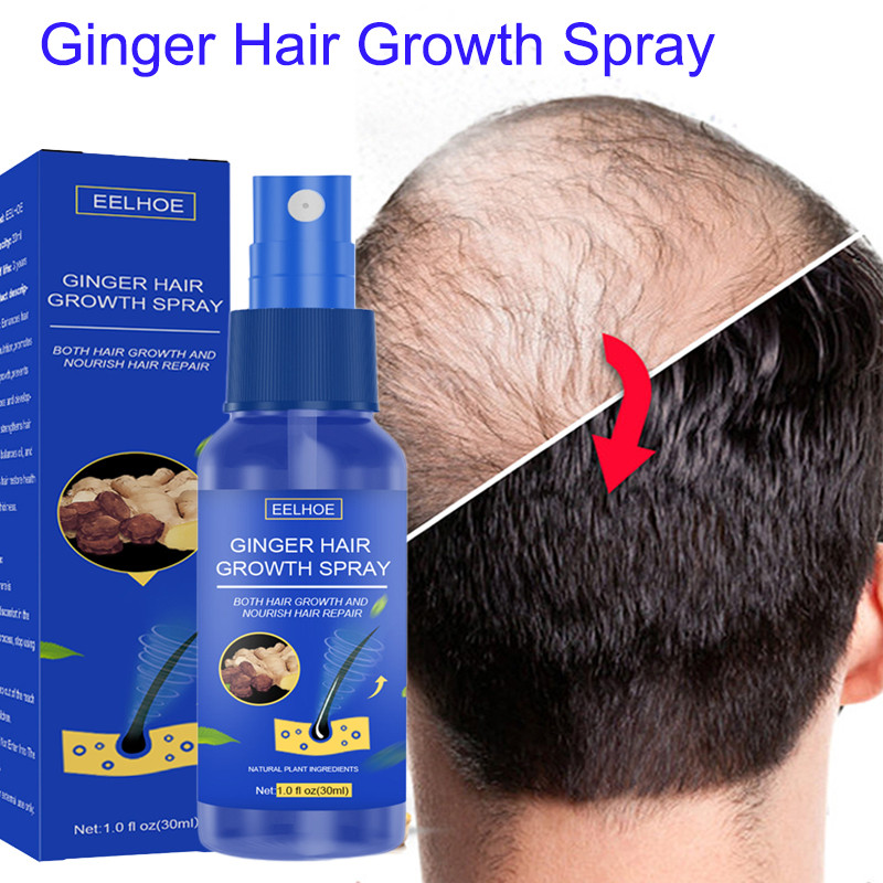 eelhoe-hair-growth-spray-promotes-hair-growth-hair-growth-spray-ginger