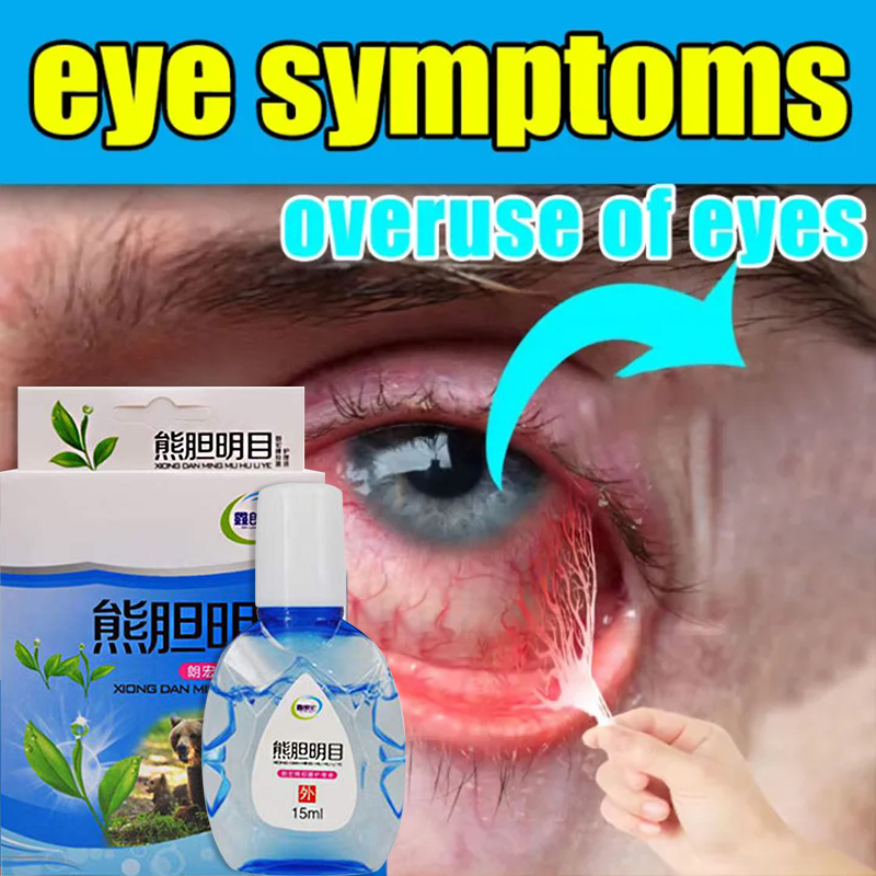 15ml original eye drops, dry eyes, bloodshot eyes, blurred eyes, red