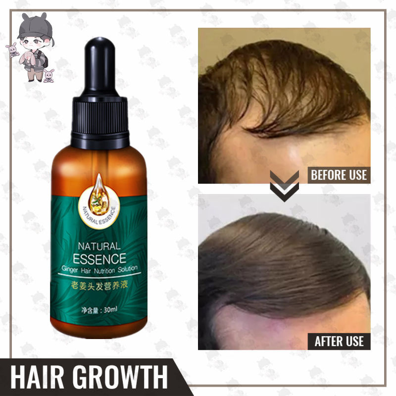 30ml Private Label Organic Fast Effective Hair Fall Loss Treatment Biotin Hair  Growth Spray Buy Hair Grow Oil,Grow Hair Treatment,Hair Growth No Side  Effects Product On | 1/2pcs Men Women Castor Oil