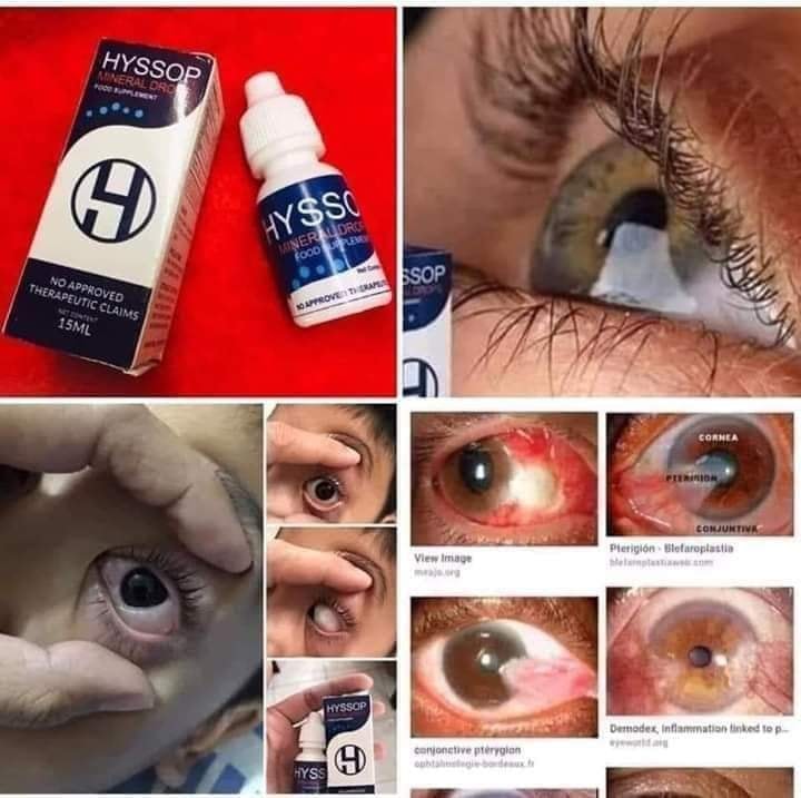 HYSSOP MINERAL EYE DROP Lazada PH