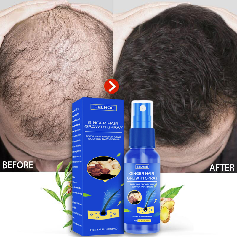 eelhoe-ginger-hair-growth-spray-hair-regrowth-liquid-anti-baldness