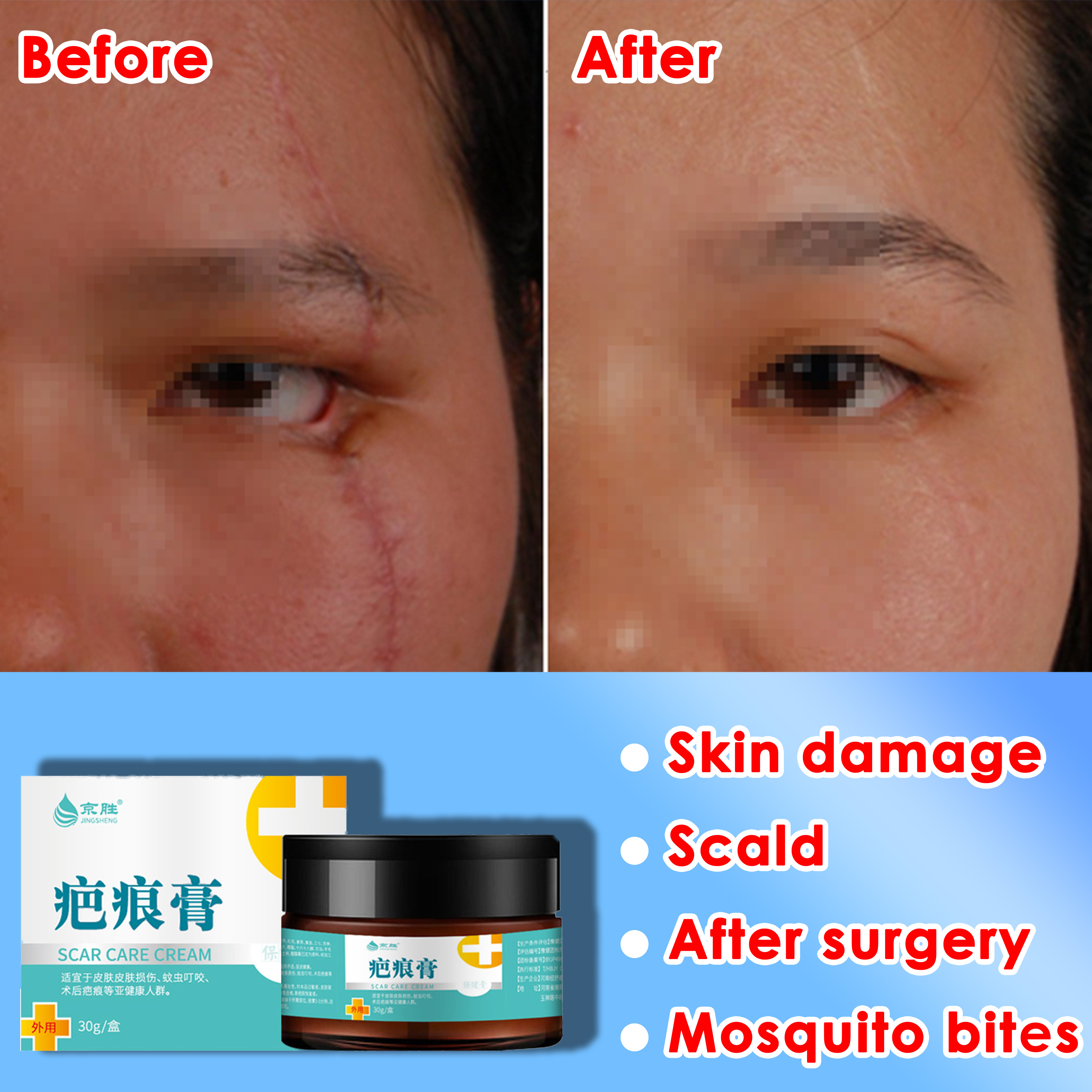100 imported Fix scar removal original Scars remover for old scars