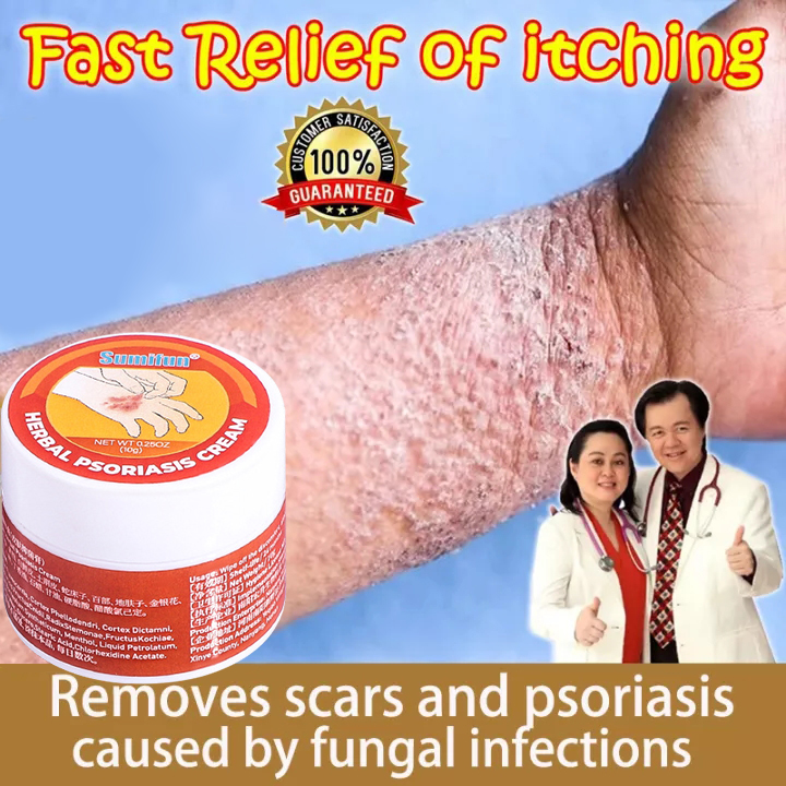 Psoriasis Cream Psoriasis Treatment Cream Psoriasis Eczema Cream Anti