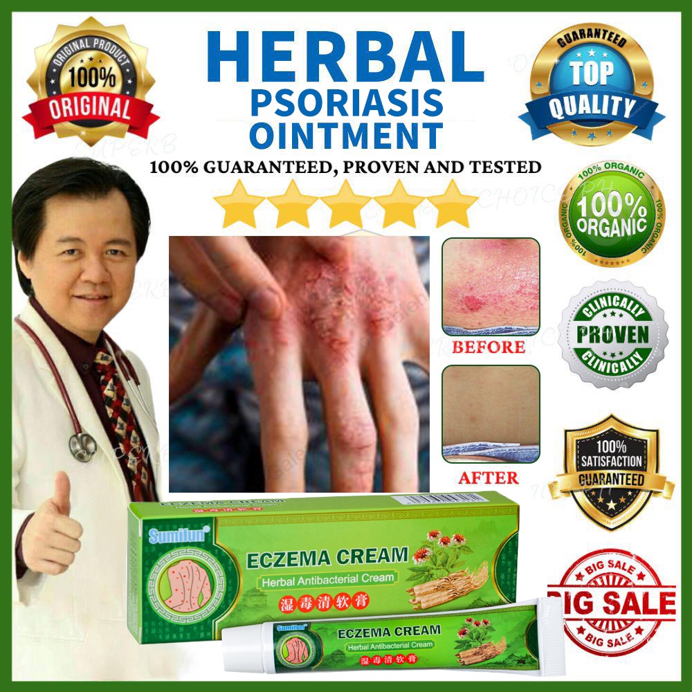 【sumifun】 Eczema Treatment Cream Gamot Sa Kati Kati Sa Balat Itchy Skin Cream Psoriasis 7777