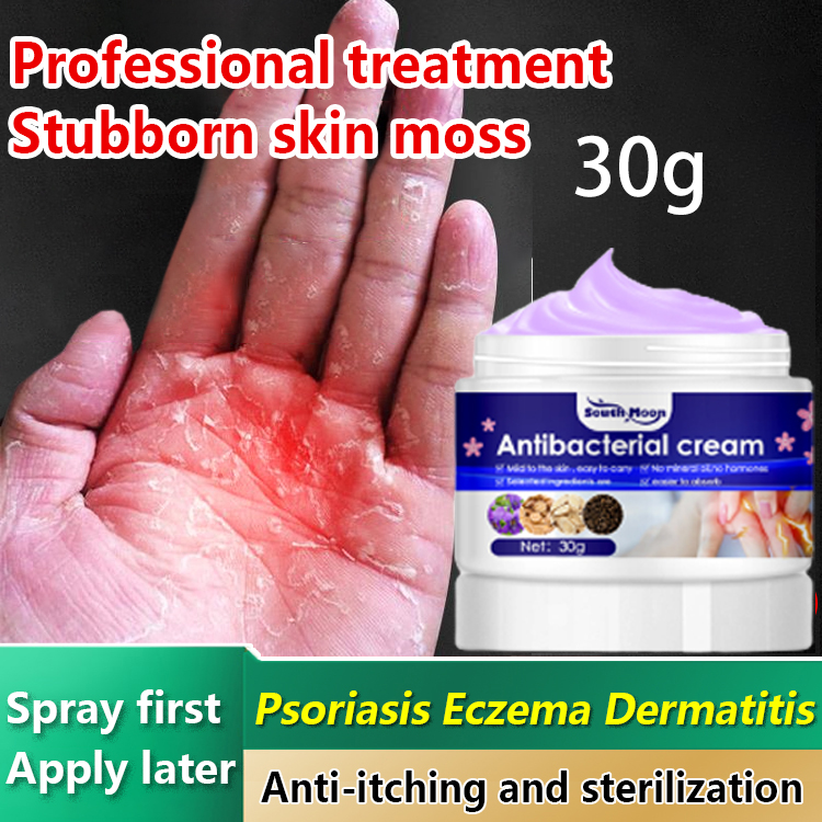 👍3 Seconds To Relieve Itching👍Sweat Herpes Treatment 30g Blisters