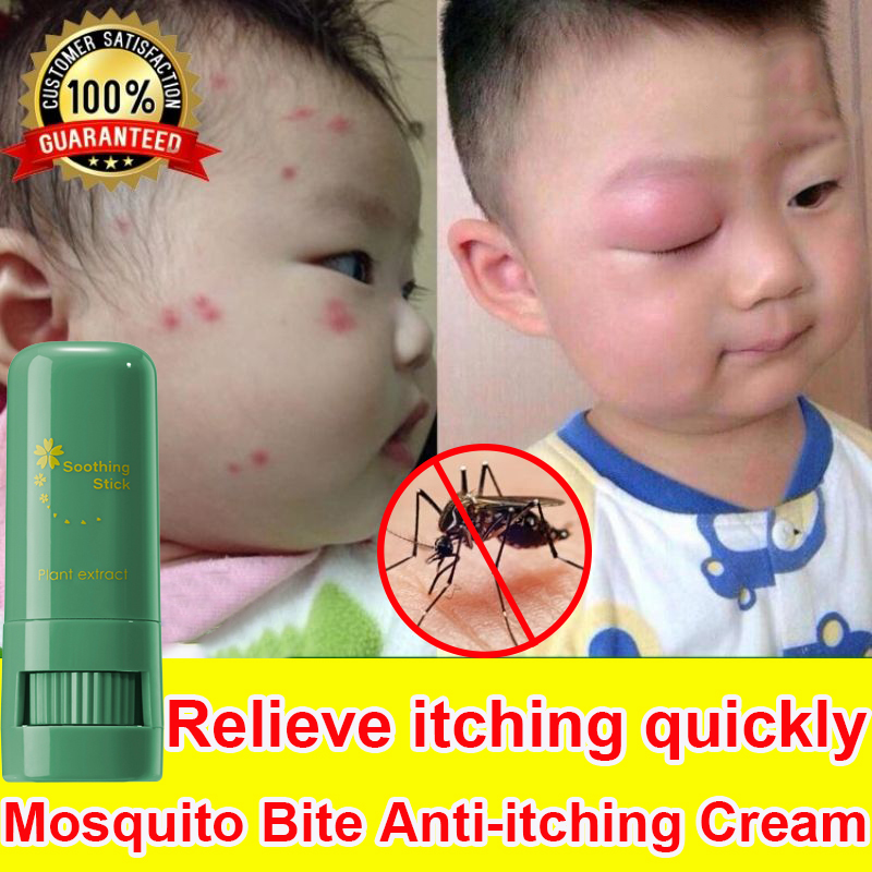Mosquito Bite Antiitching Cream Prevent Mosquito Bites Safe for Kids and Infants Detumescence