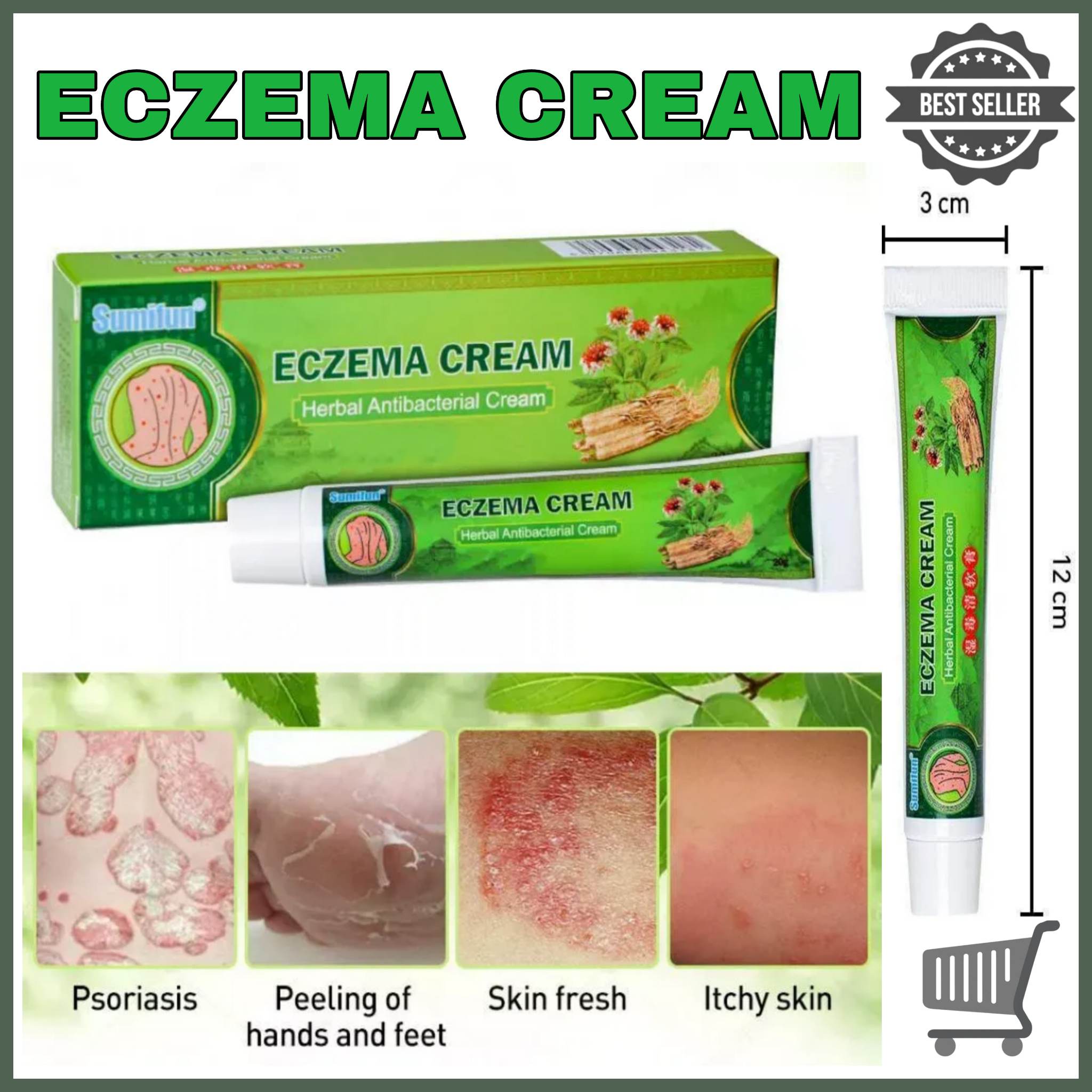 100 Effective Sumifun Eczema Treatment Cream Gamot Sa Kati Kati Sa Balat Buni Psoriasis 5083