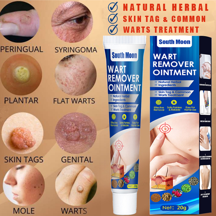 South Moon Warts Remover Original Cream Warts Magic Remover Warts Remover Skin Kulugo Remover 2572