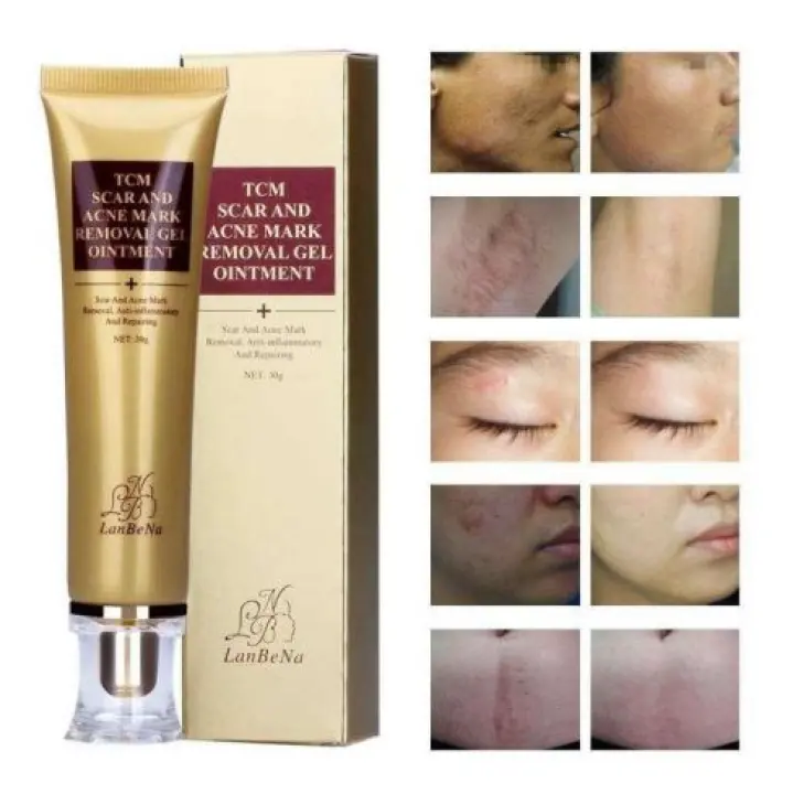 tcm scar gel