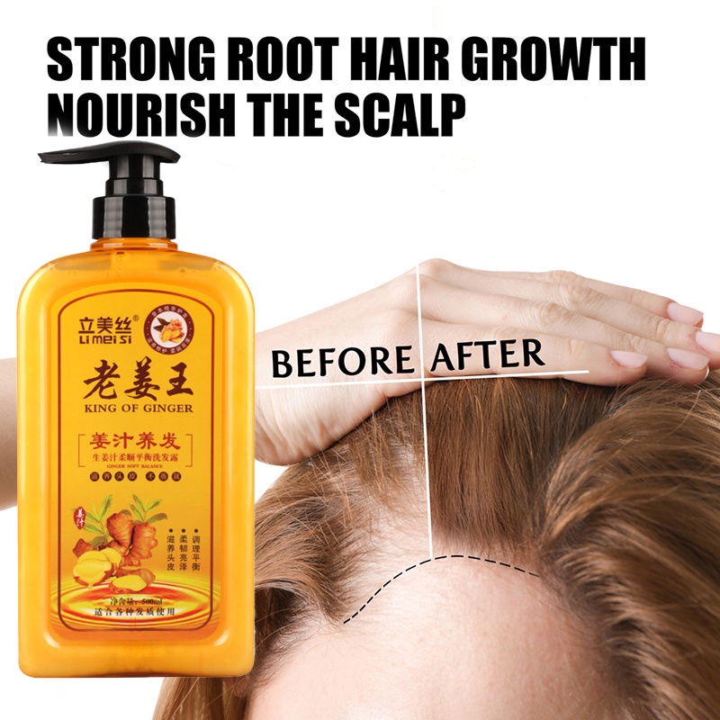 Ginger King Shampoo 750ml Natural Ingredients Added Anti Hair Loss Hair Care Shampoo Hair