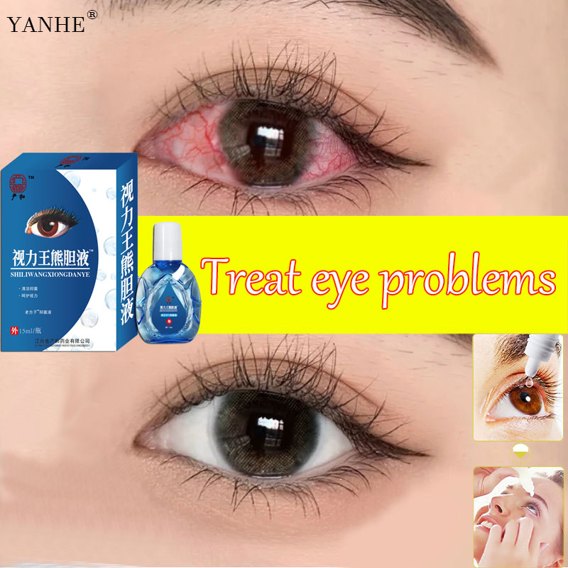 Fresh and BrightYANHE® eye drops for clear vision 10 ML,Relieve visual