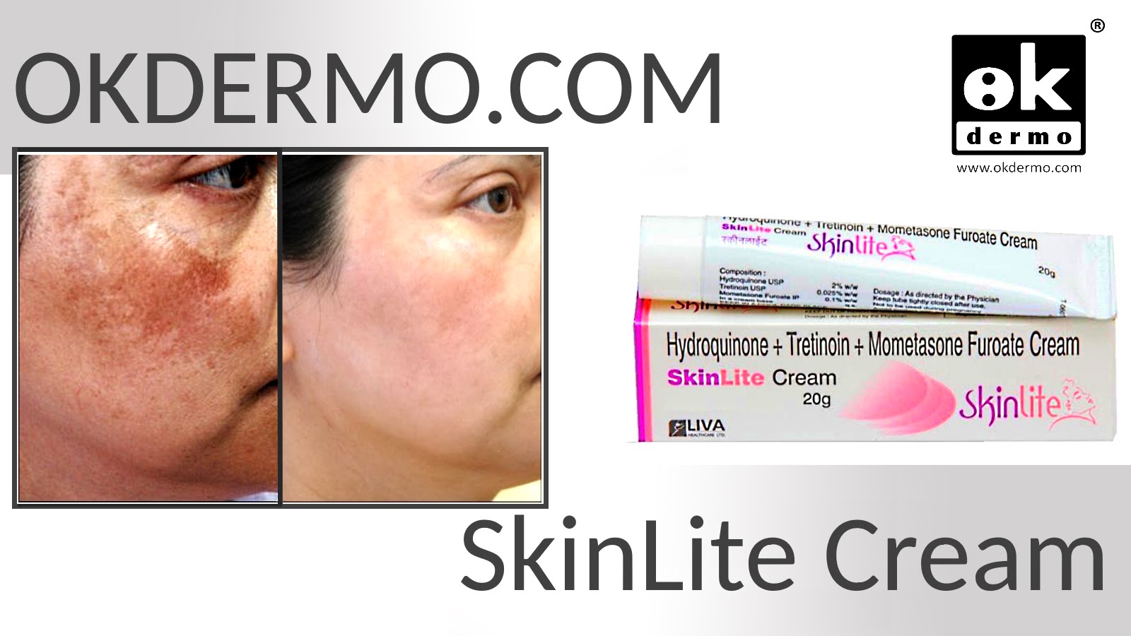 mometasone furoate cream for dark spots