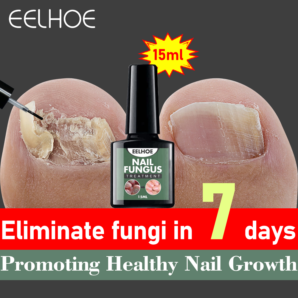 EELHOE Nail Repair Essence Serum Fungal Nail Treatment Remove