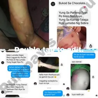 all natural diaper rash cream