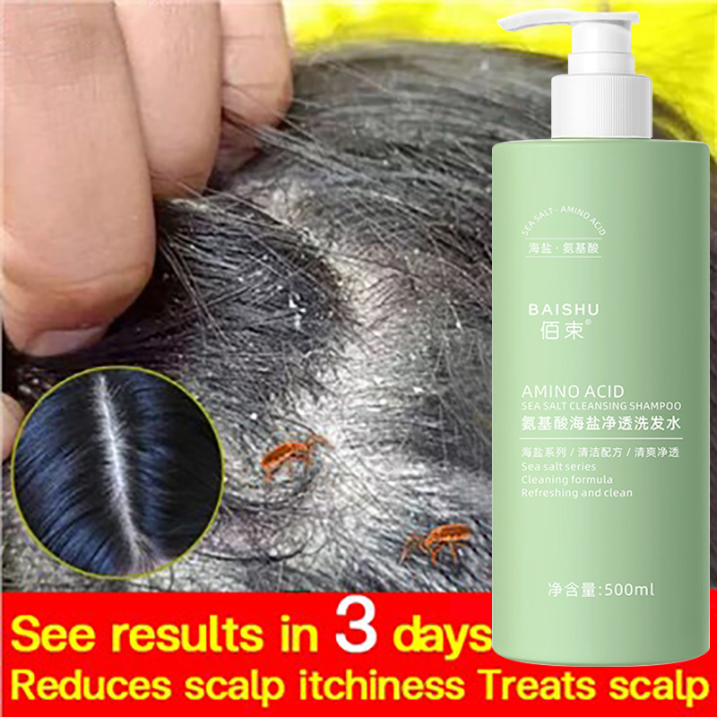 Amino Acid Sea Salt Anti Dandruff Shampoo Deep cleaning, get rid of