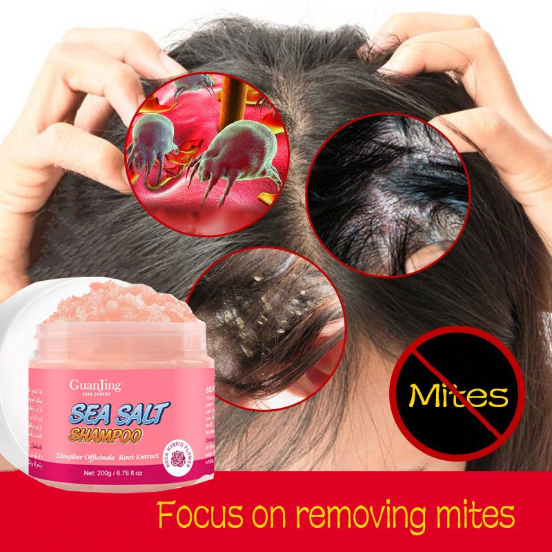 Rose Sea Salt Anti Dandruff Shampoo For Dandruff and Scalp Treatment