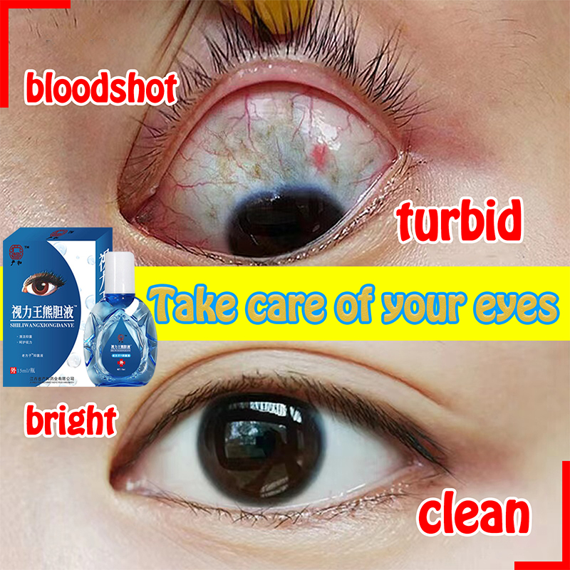 YANHE eye drops for clear vision Relieve visual fatigue and ...