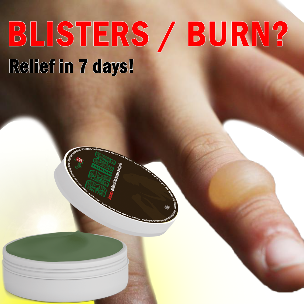 BRIM Skin Burn and Blisters Ointment , skin burn ointment , skin burn