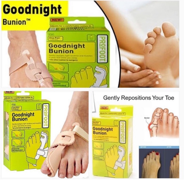 Goodnight Bunion Profoot Lazada PH