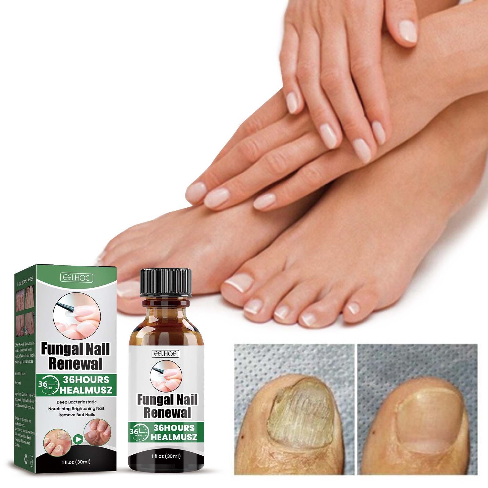 100 Effective Nail Fungus Treatment Nail Repair Ingrown Toenail