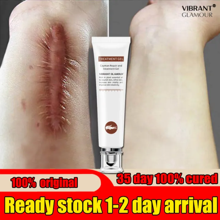 crocodile scar cream